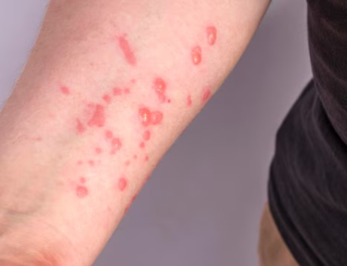 Editorial – Alerta ligado Editorial – Alerta ligado